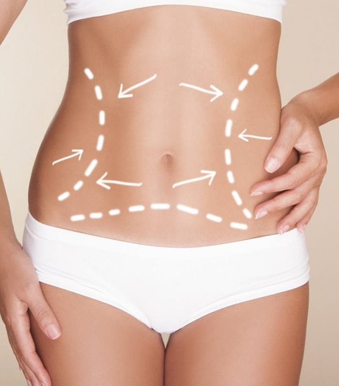 Lipoaspiração e Lipoescultura
